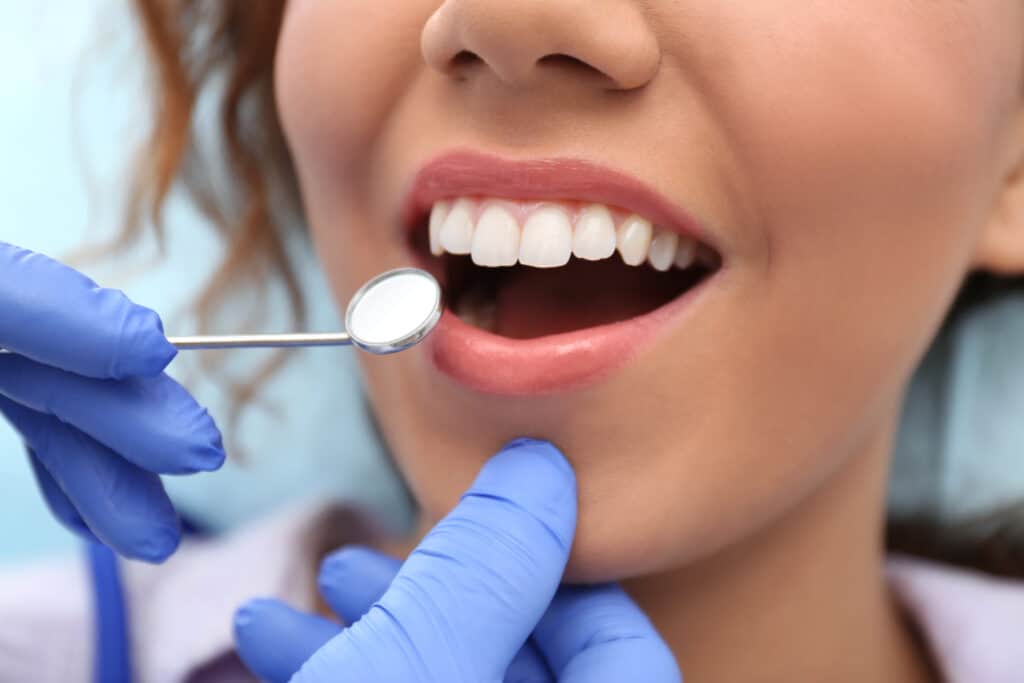 teeth whitening taylorsville