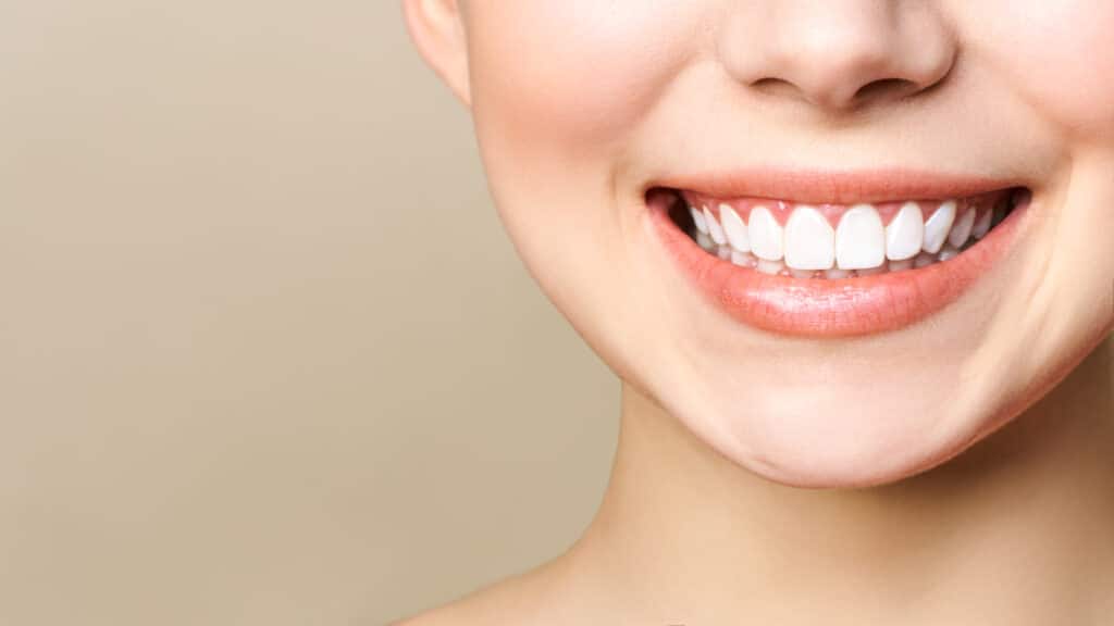 teeth whitening taylorsville